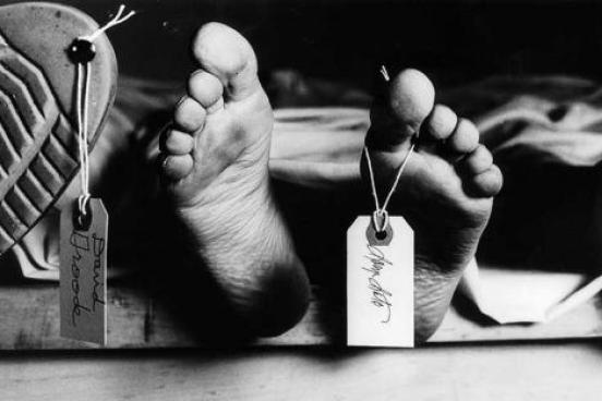 Black and white of feet with a toe tag.